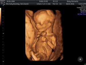 14 weeks 4d baby scan